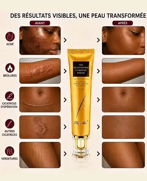 Gel Anti-Cicatrices — vue 2